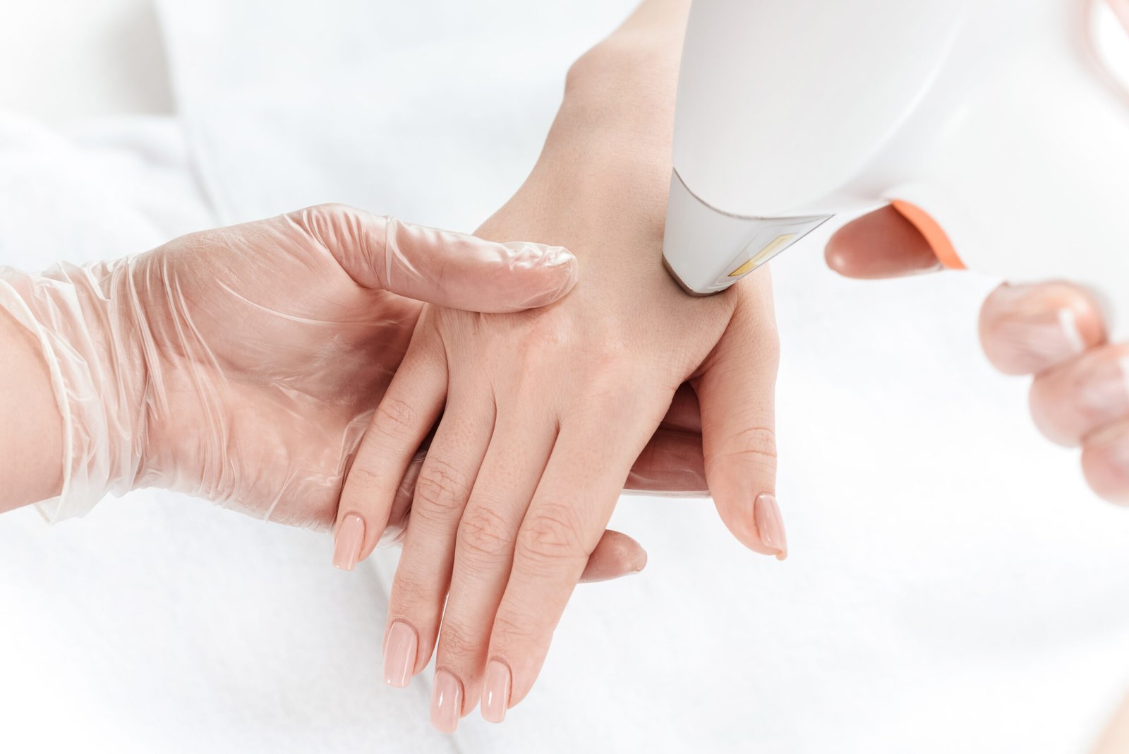 Close-up partial view of woman receiving laser skin treatment on hands at Couture Dermatology and Laser