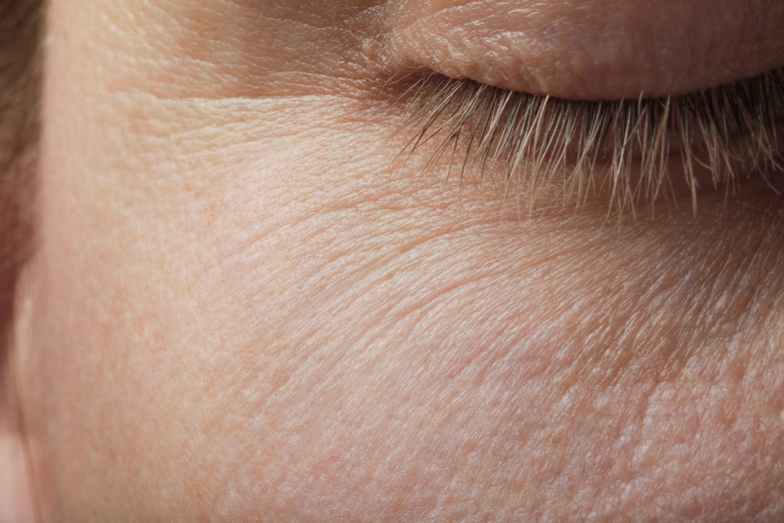 Close-up of woman with smooth, softened skin at Couture Dermatology and Laser Beverly Hills