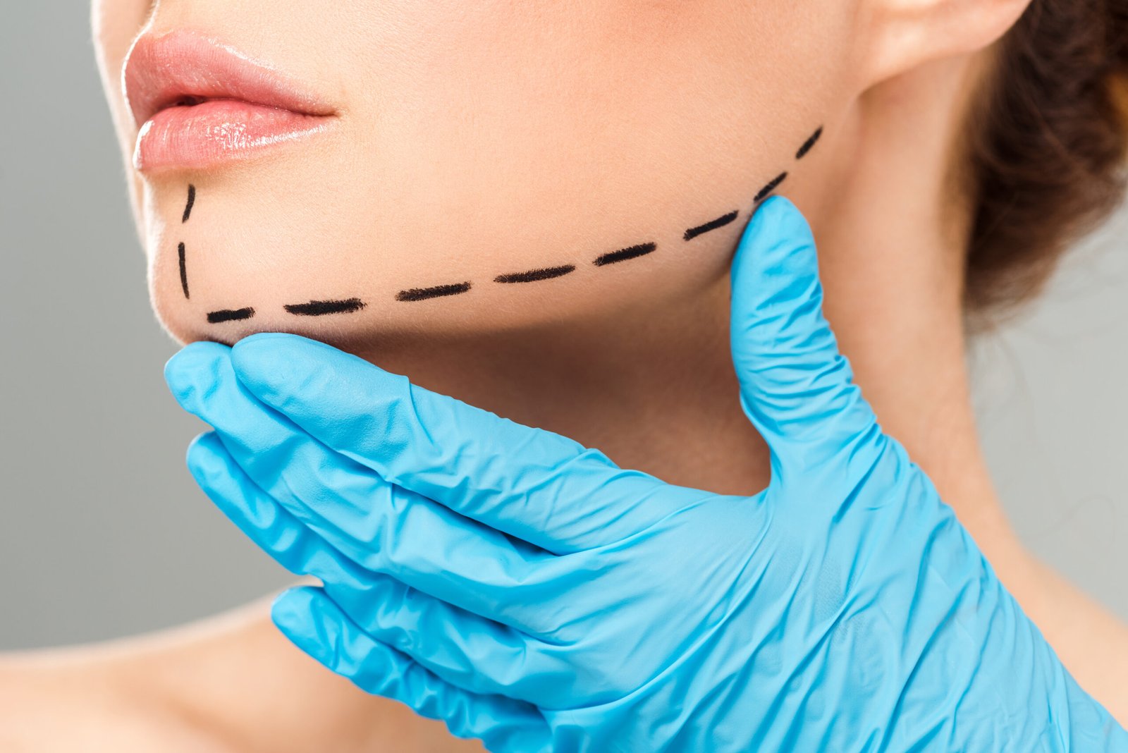 Dermatologist assessing chin structure for non-surgical contouring at Couture Dermatology and Laser Beverly Hills