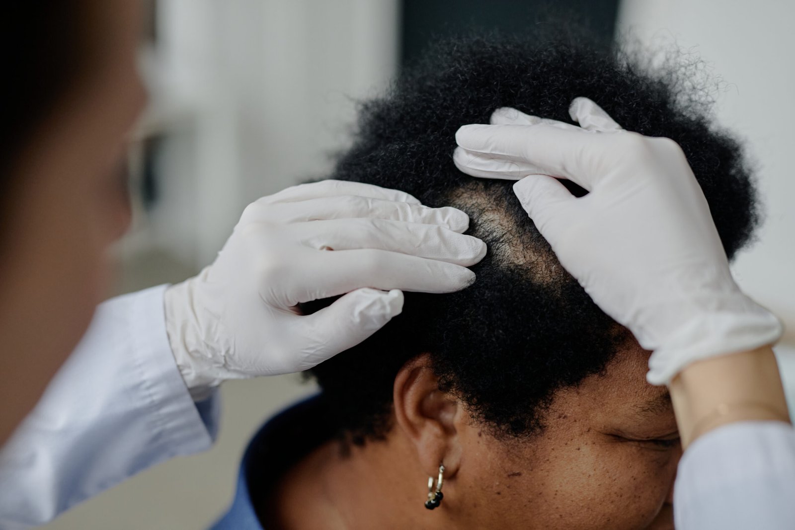 Dermatologist examining patient scalp for hair loss at Couture Dermatology and Laser Beverly Hills