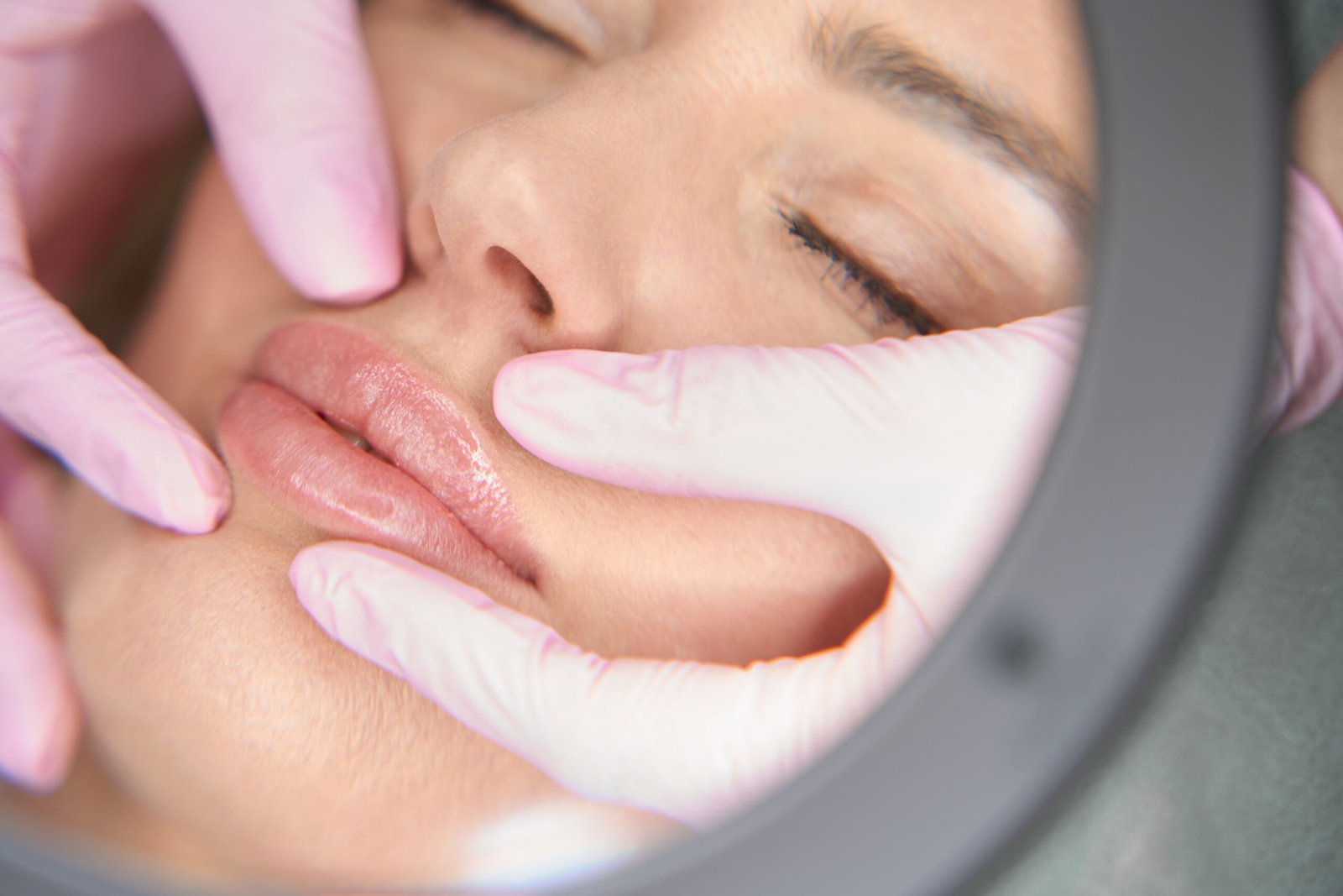 Specialist cosmetologist examining lip contour of patient at Couture Dermatology and Laser Beverly Hills