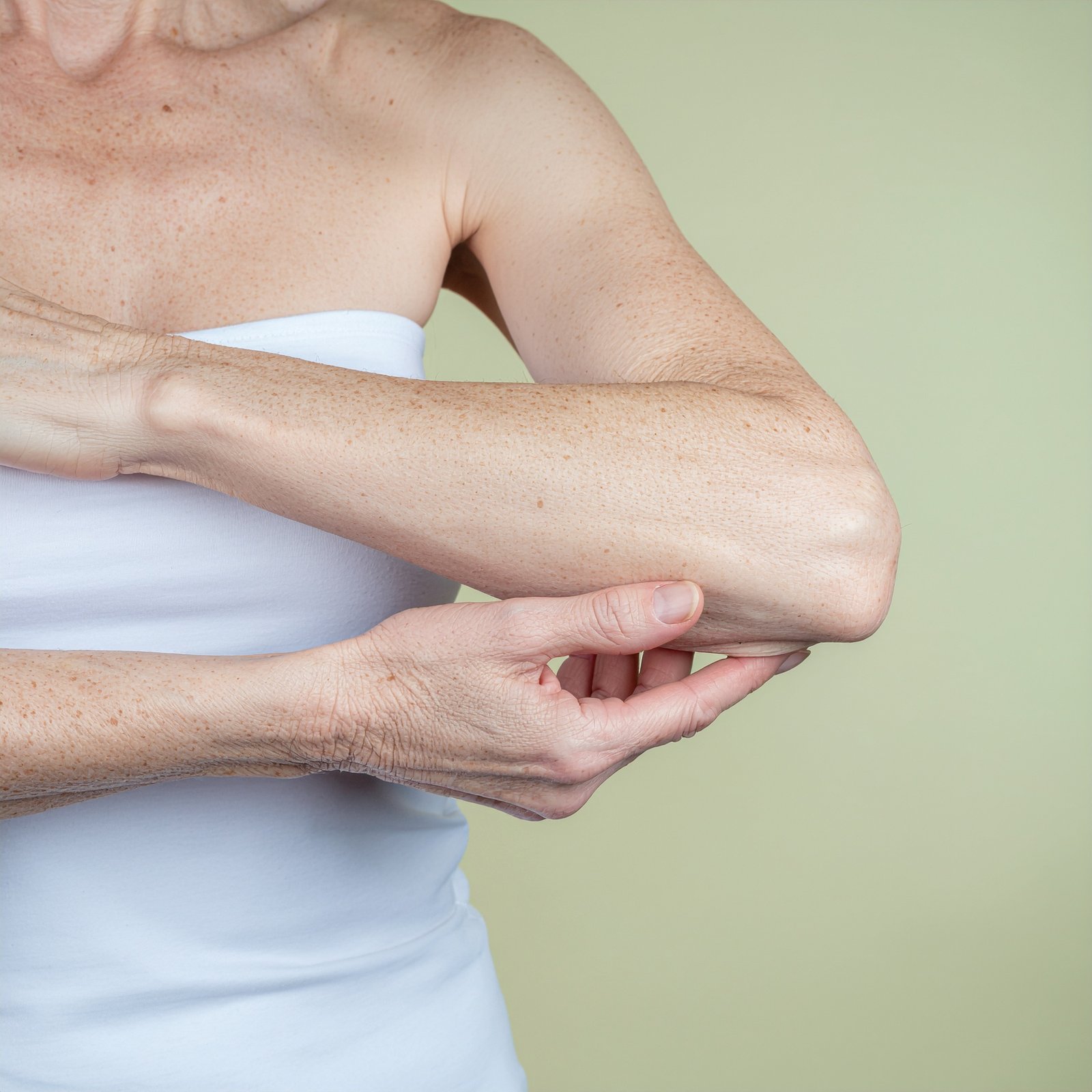 Clinical assessment of eczema at Couture Dermatology and Laser Beverly Hills