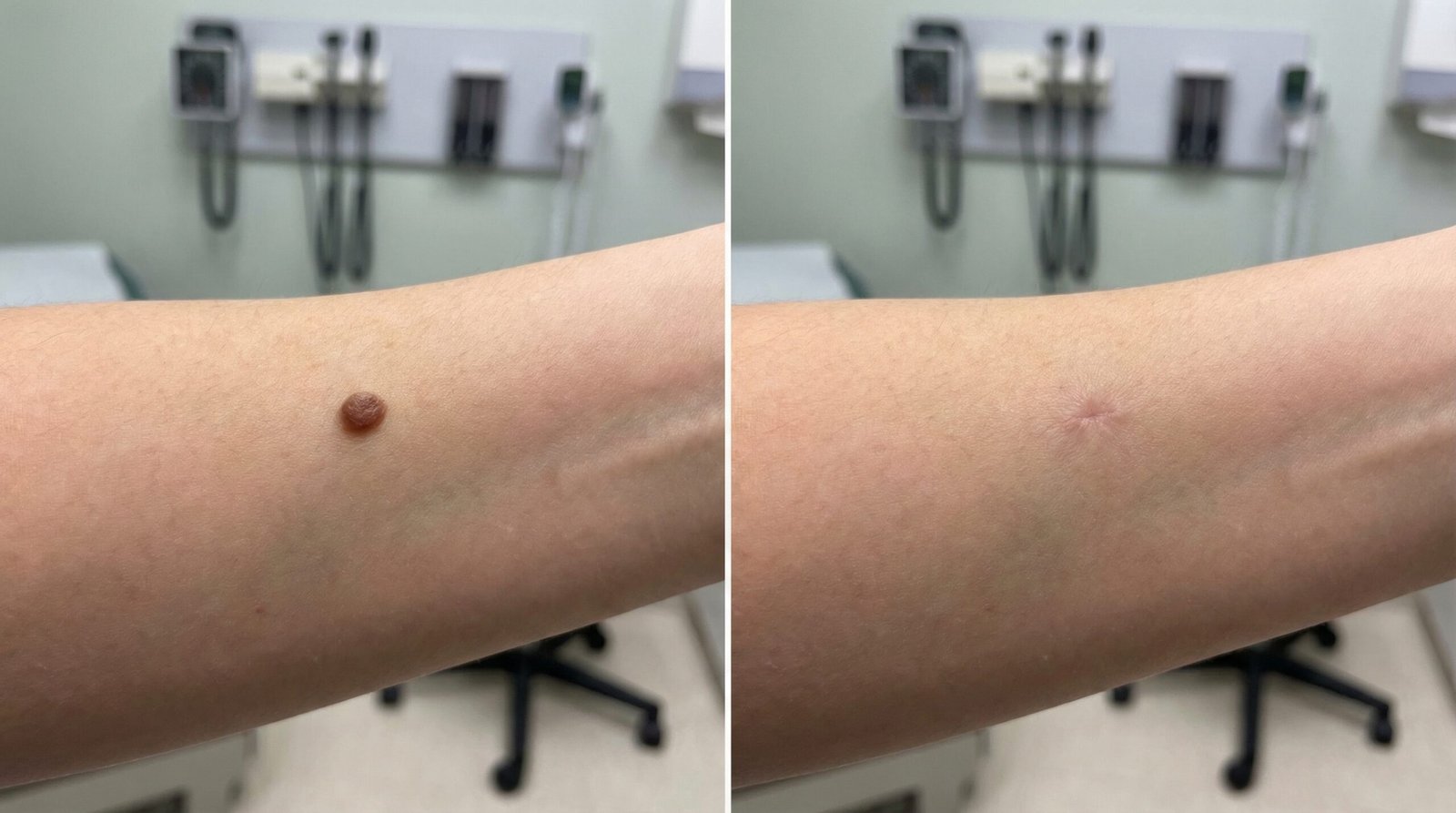 Full Body Skin Exam results at Couture Dermatology and Laser Beverly Hills